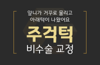 주걱턱 비수술교정_200326.png