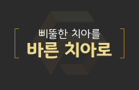 삐뚤한 치아를 바른치아로_200330.png