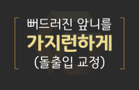 뻐드러진 앞니를 가지런하게_200330.png