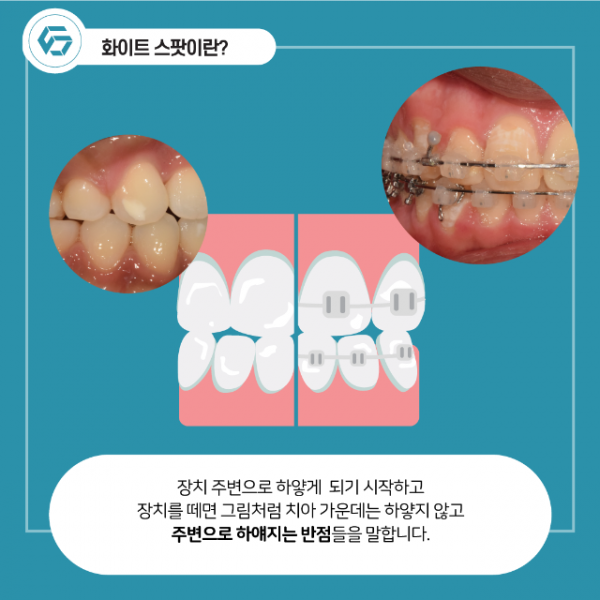 12월_교정_화이트스팟_3.png
