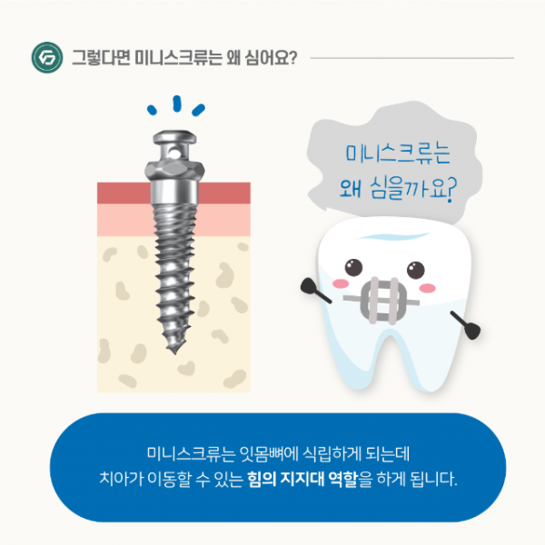 1월_교정_미니스크류_4.png