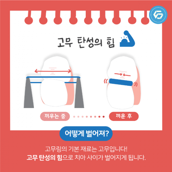 5월_교정_세퍼레이션링_3.png
