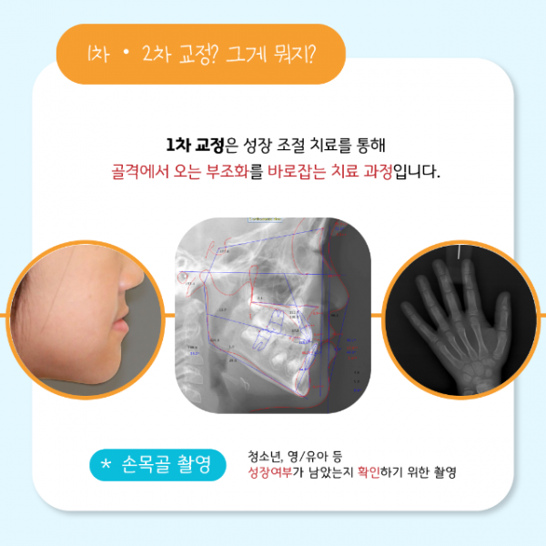 6월_소아교정_2.png
