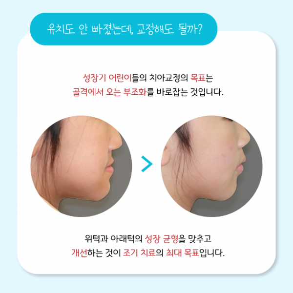 6월_소아교정_5.png