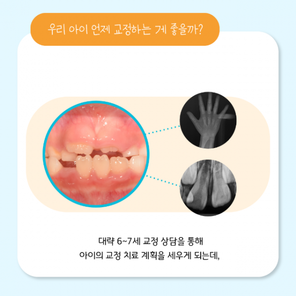 6월_소아교정_8.png