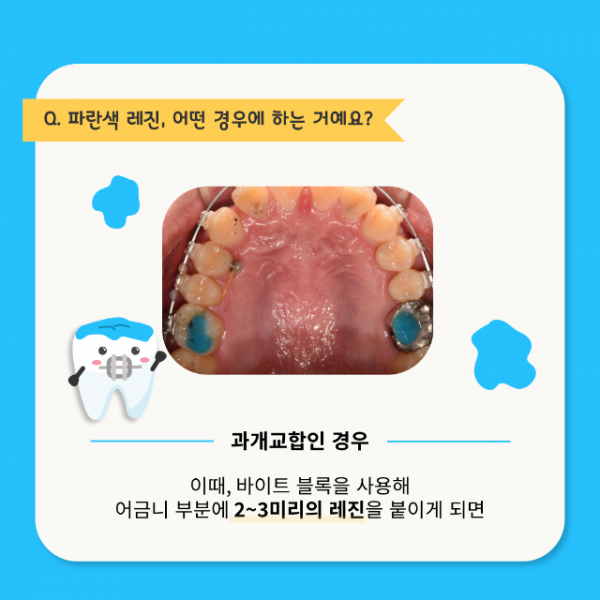 9월_교정_바이트블록_4.png