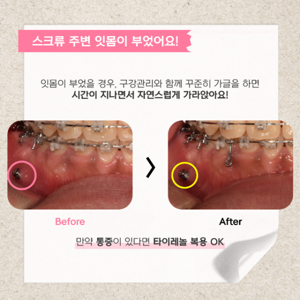 스크류질문_7.png