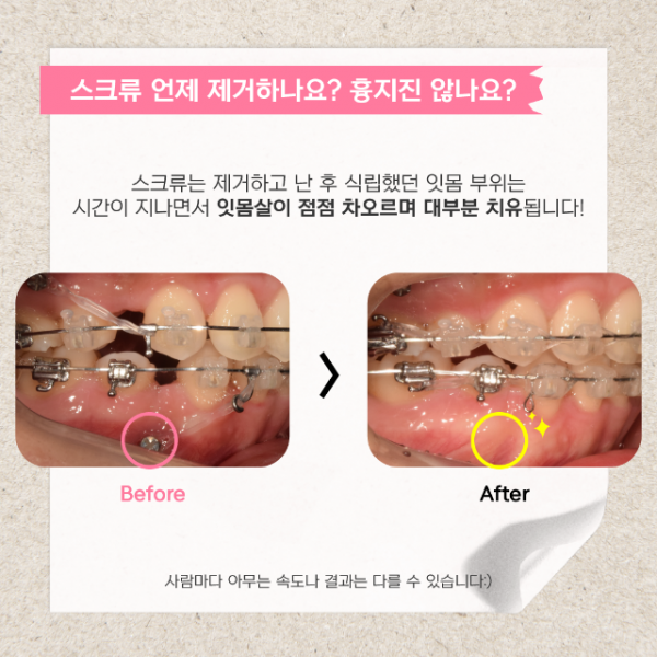 스크류질문_14.png